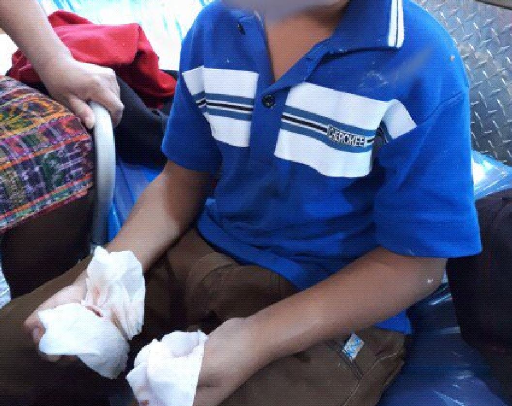 Niños amputados por bombas EU Emisoras Unidas Guatemala