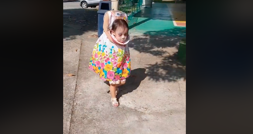 niña sin cabeza disfraz viral