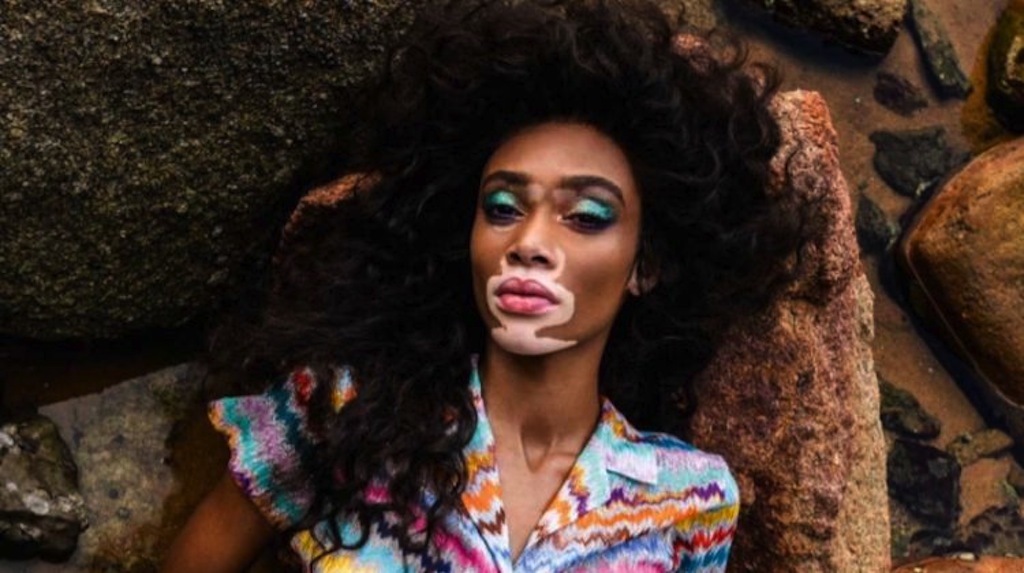 Winnie Harlow